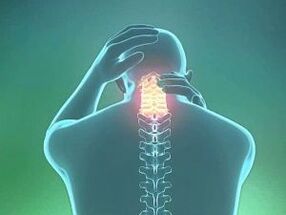 Symptómom cervikálnej osteochondrózy je bolesť hlavy