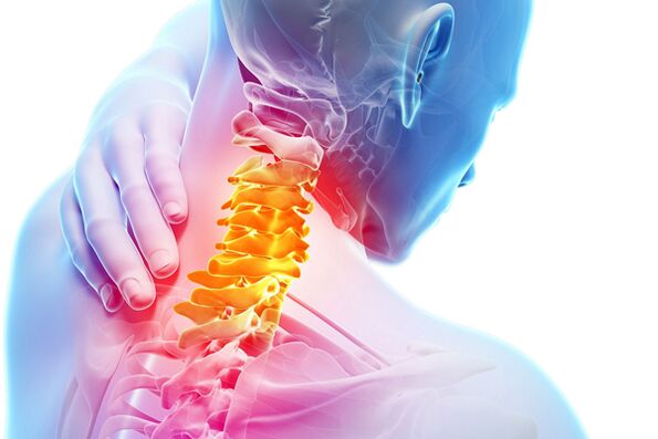 Cervikálna osteochondróza