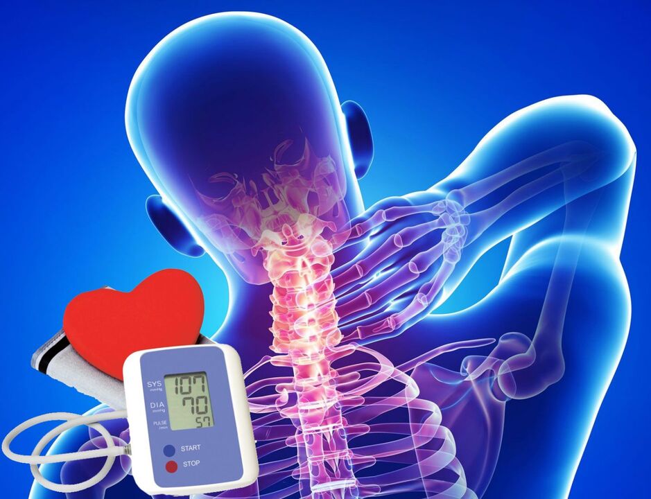 Skoky krvného tlaku s cervikálnou osteochondrózou