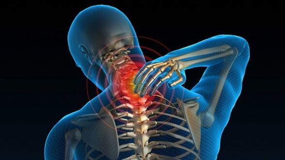 Bolesť pri otáčaní krku môže naznačovať syndróm vertebrálnej cervikálnej osteochondrózy