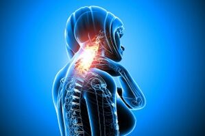 osteochondróza v krčnej chrbtici